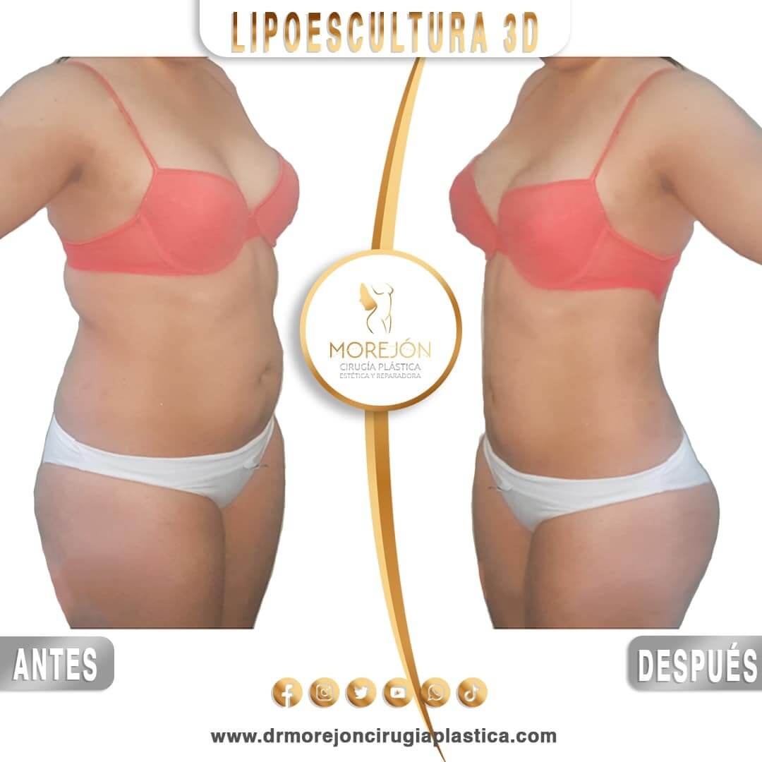 Dr. Diego Armando Morejón Cirujano Plástico Cochabamba