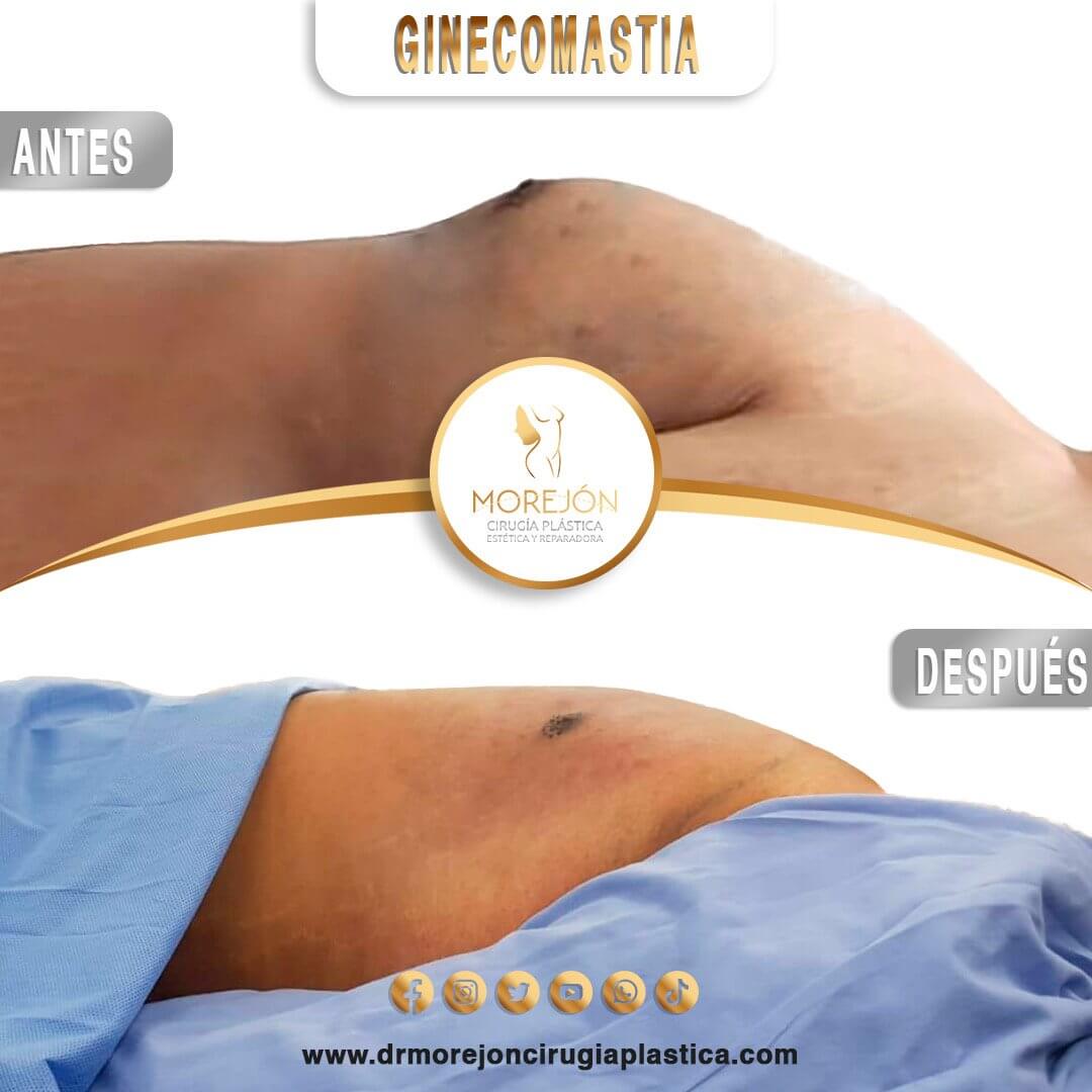 Dr. Diego Armando Morejón Cirujano Plástico Cochabamba