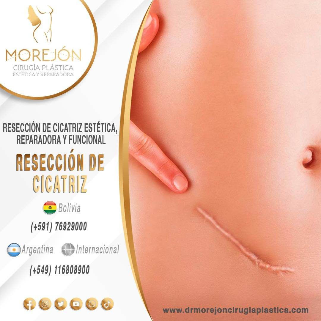 Dr. Diego Armando Morejón Cirujano Plástico Cochabamba