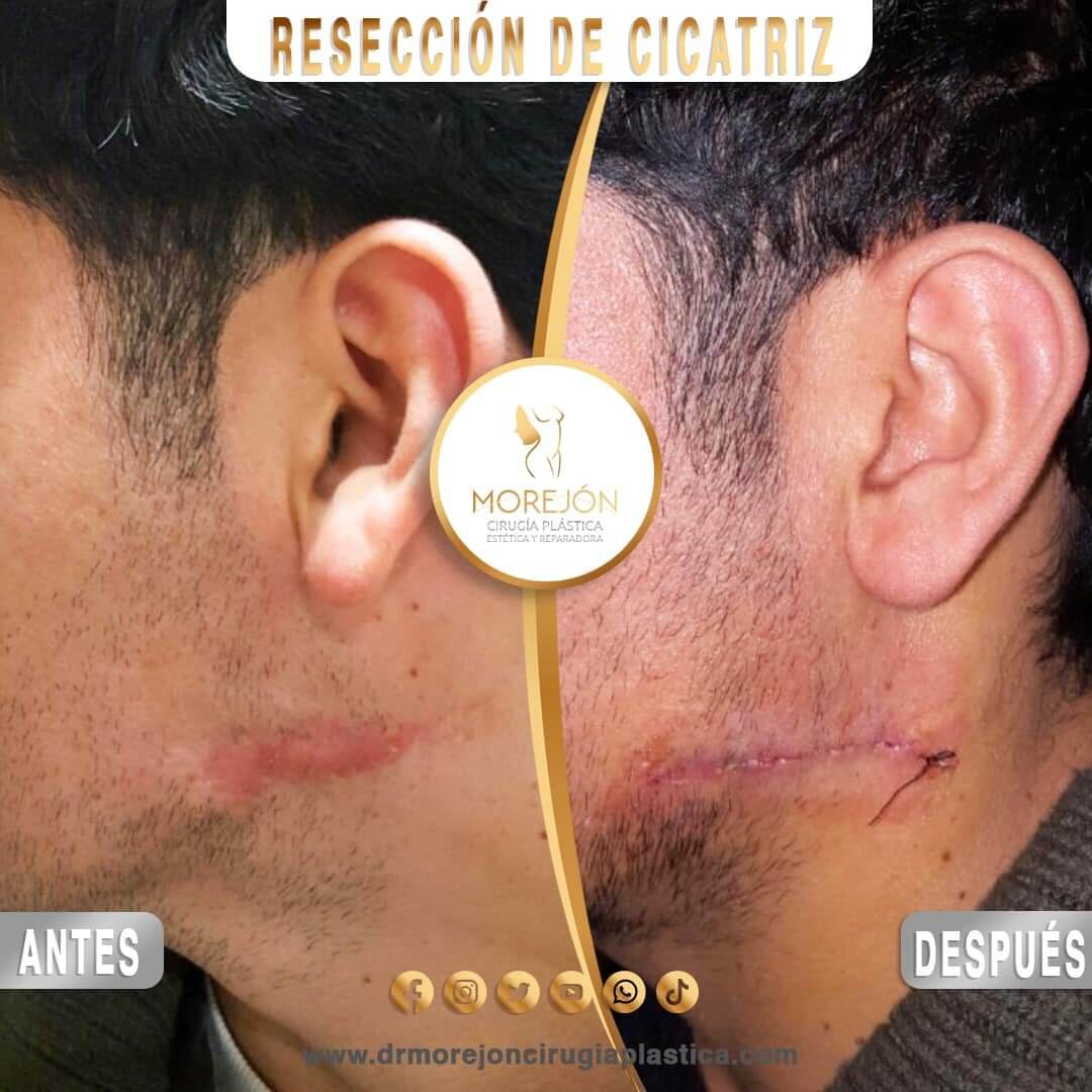 Dr. Diego Armando Morejón Cirujano Plástico Cochabamba