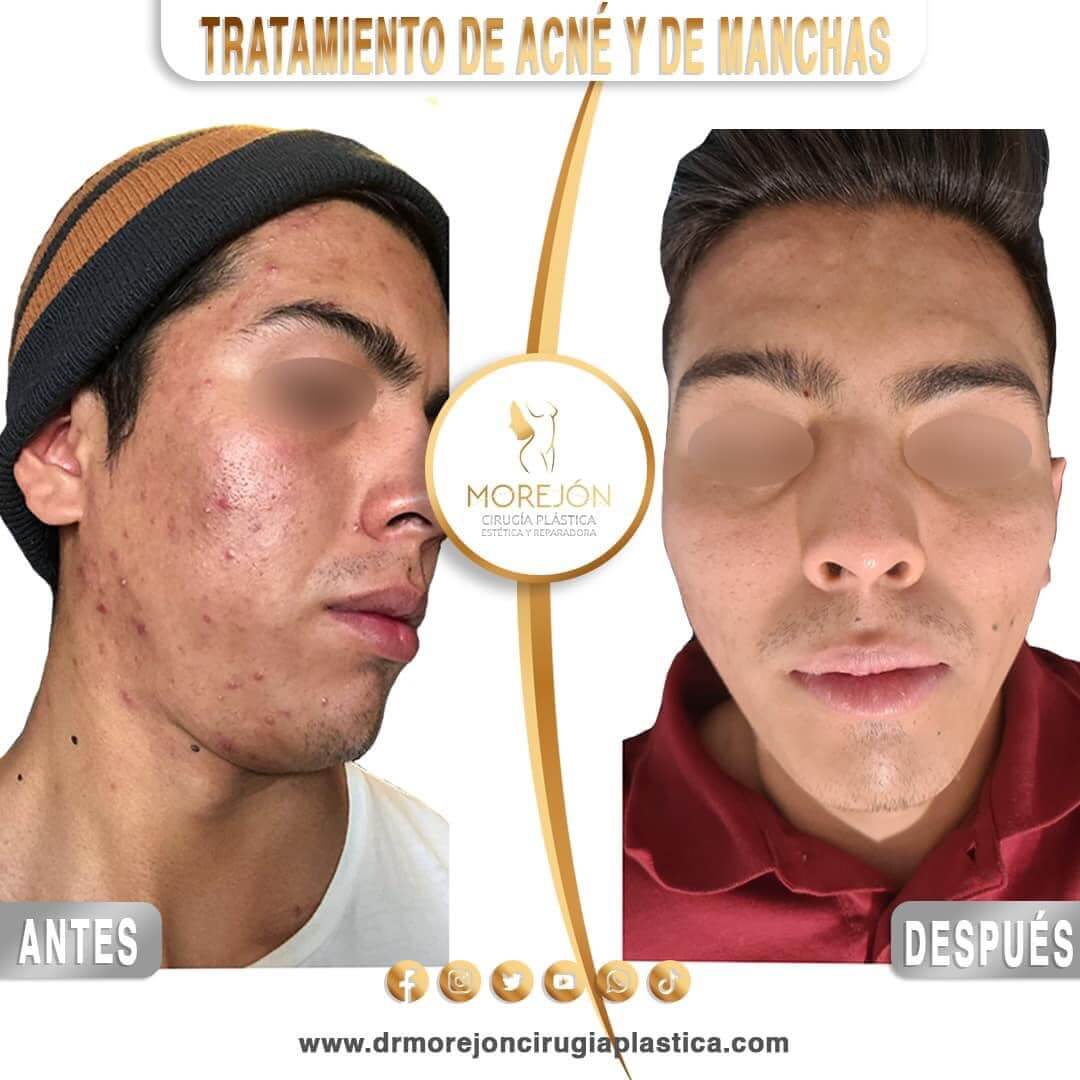 Dr. Diego Armando Morejón Cirujano Plástico Cochabamba