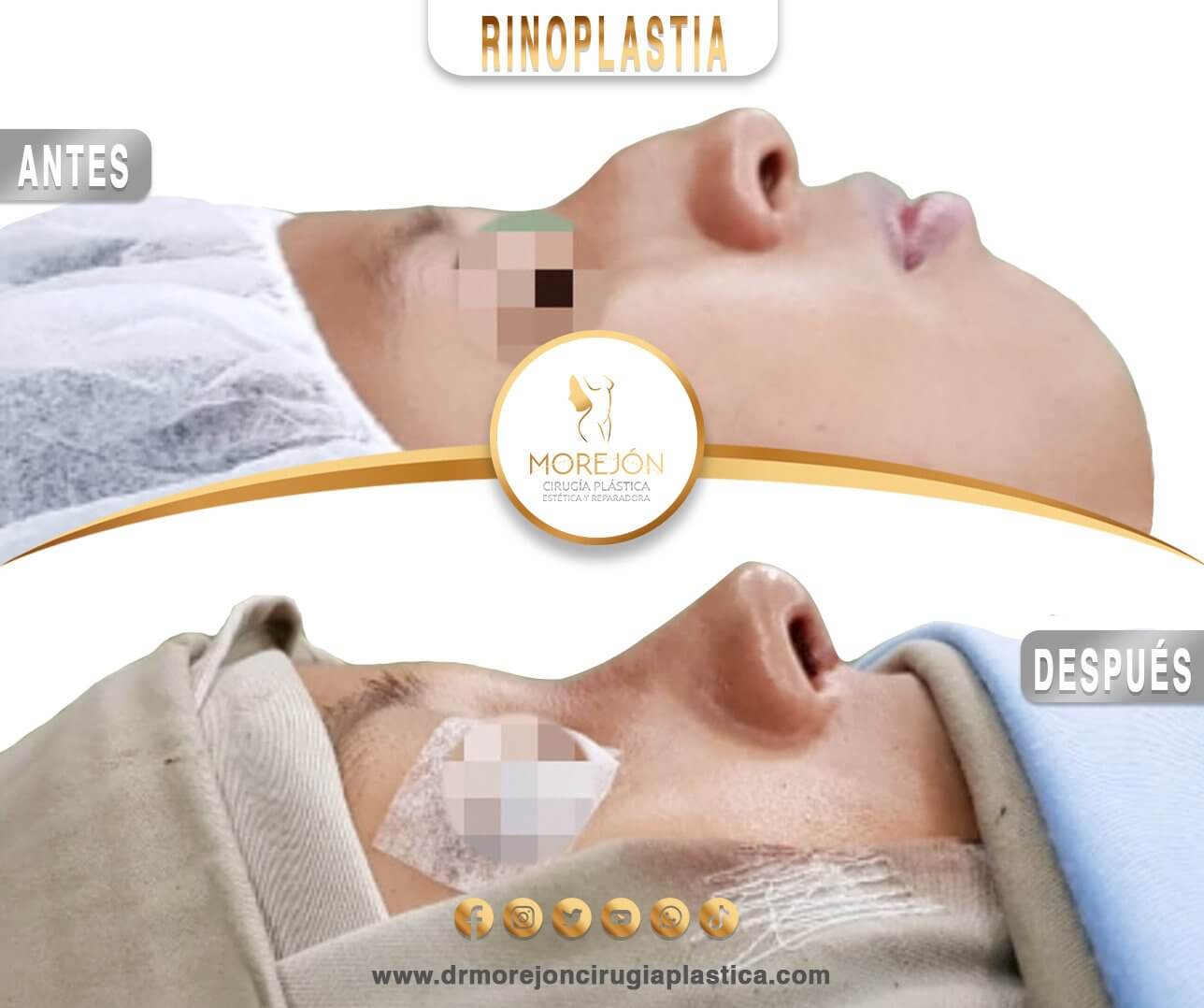 Dr. Diego Armando Morejón Cirujano Plástico Cochabamba