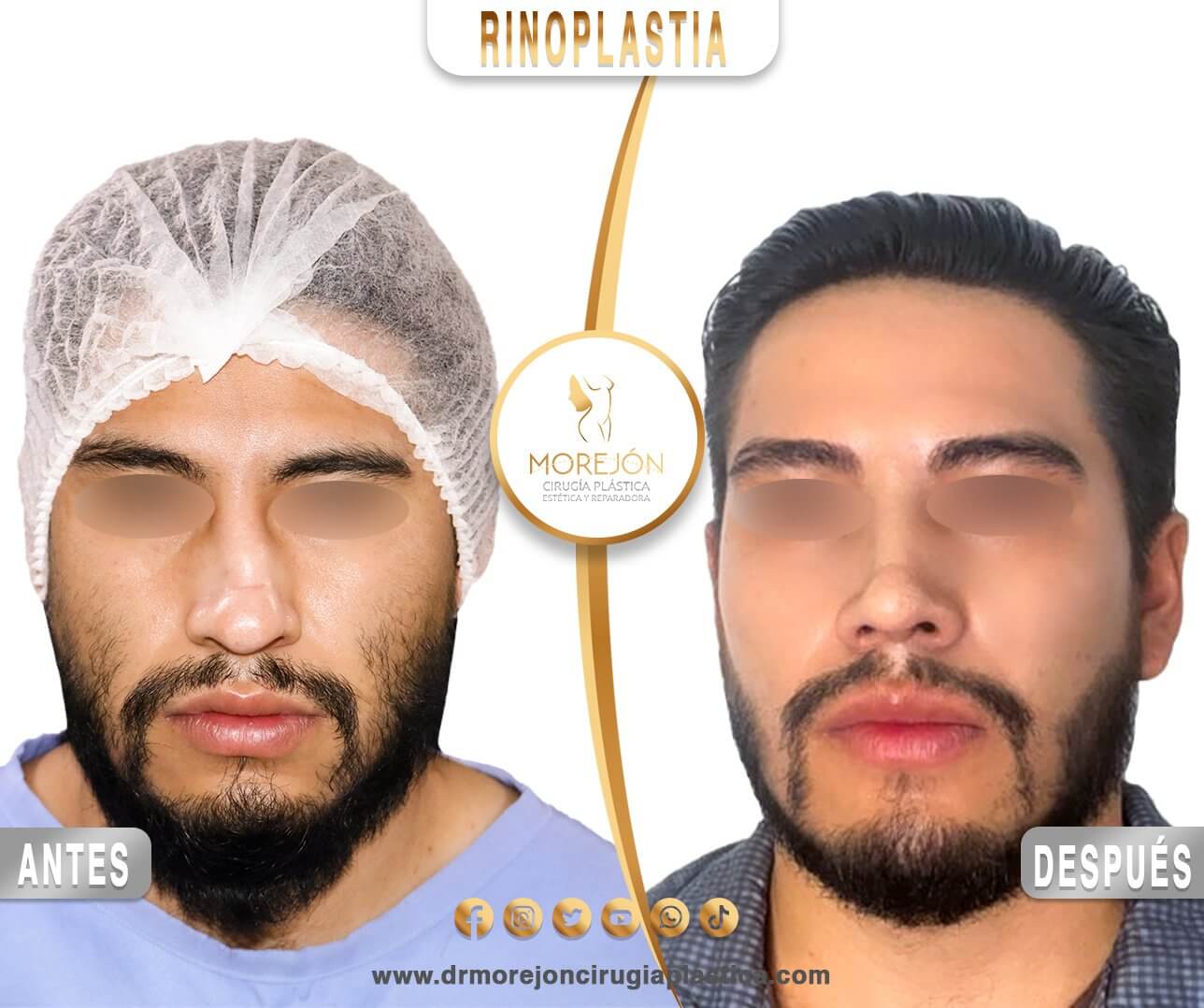 Dr. Diego Armando Morejón Cirujano Plástico Cochabamba