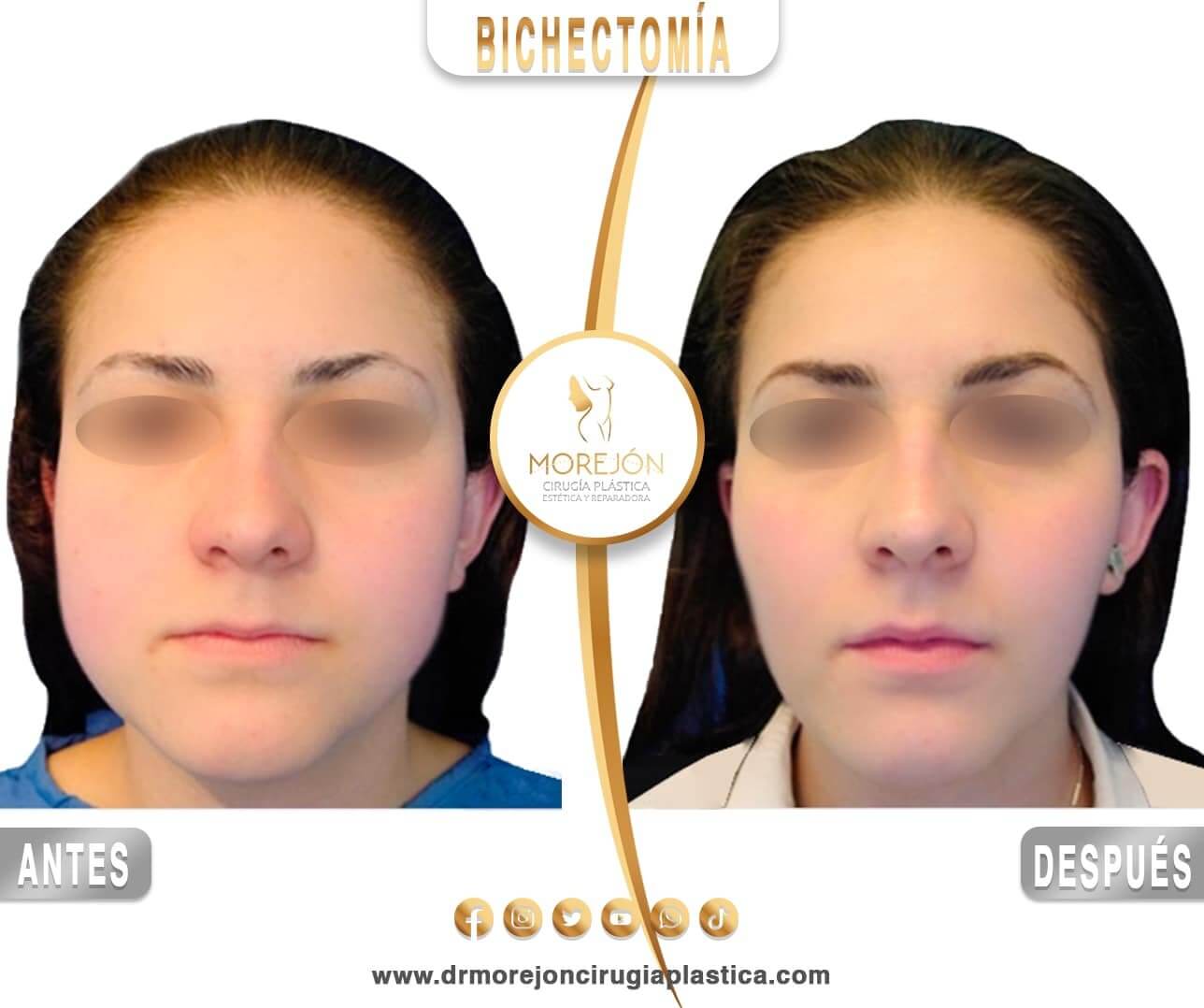 Dr. Diego Armando Morejón Cirujano Plástico Cochabamba