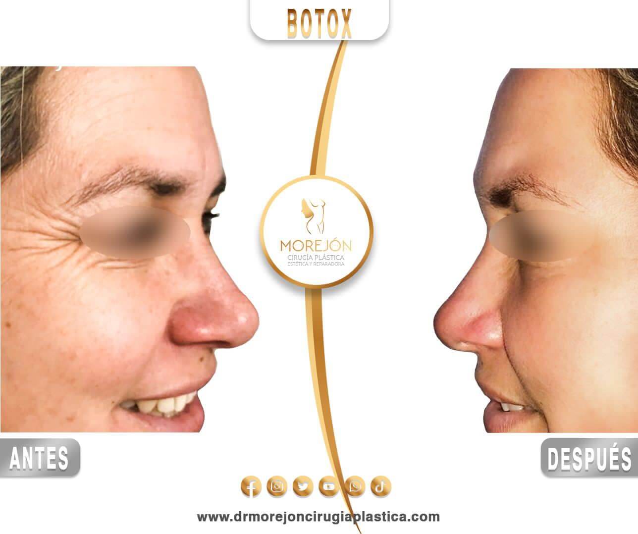 Dr. Diego Armando Morejón Cirujano Plástico Cochabamba