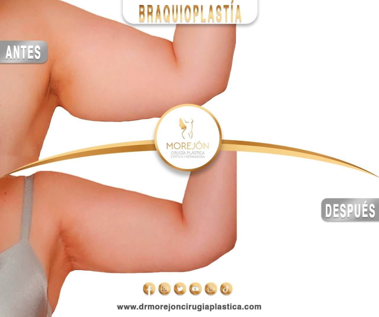 Dr. Diego Armando Morejón Cirujano Plástico Cochabamba