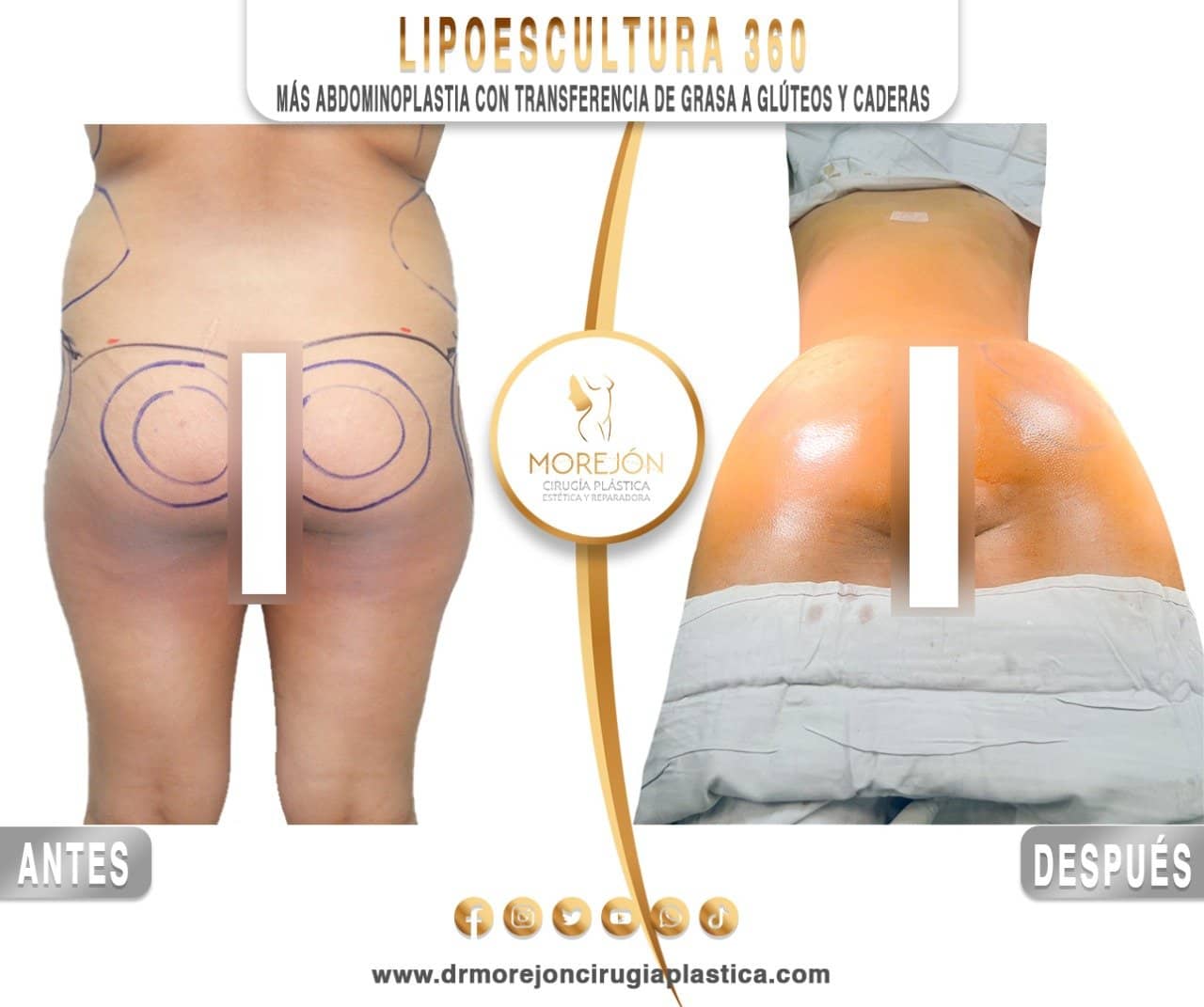 Dr. Diego Armando Morejón Cirujano Plástico Cochabamba