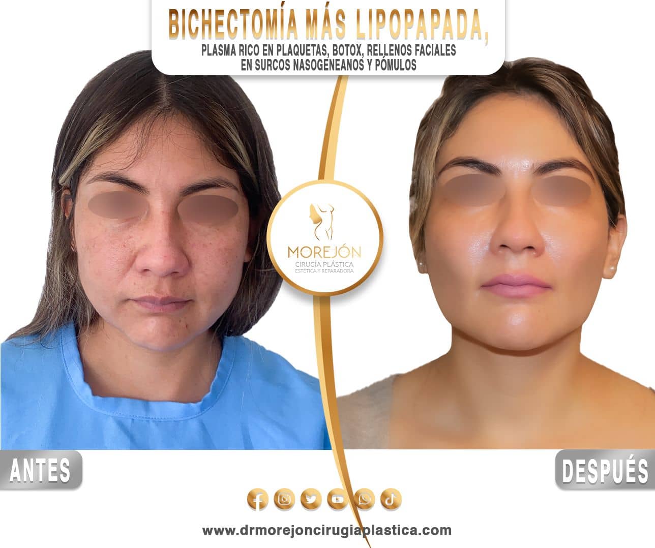 Dr. Diego Armando Morejón Cirujano Plástico Cochabamba