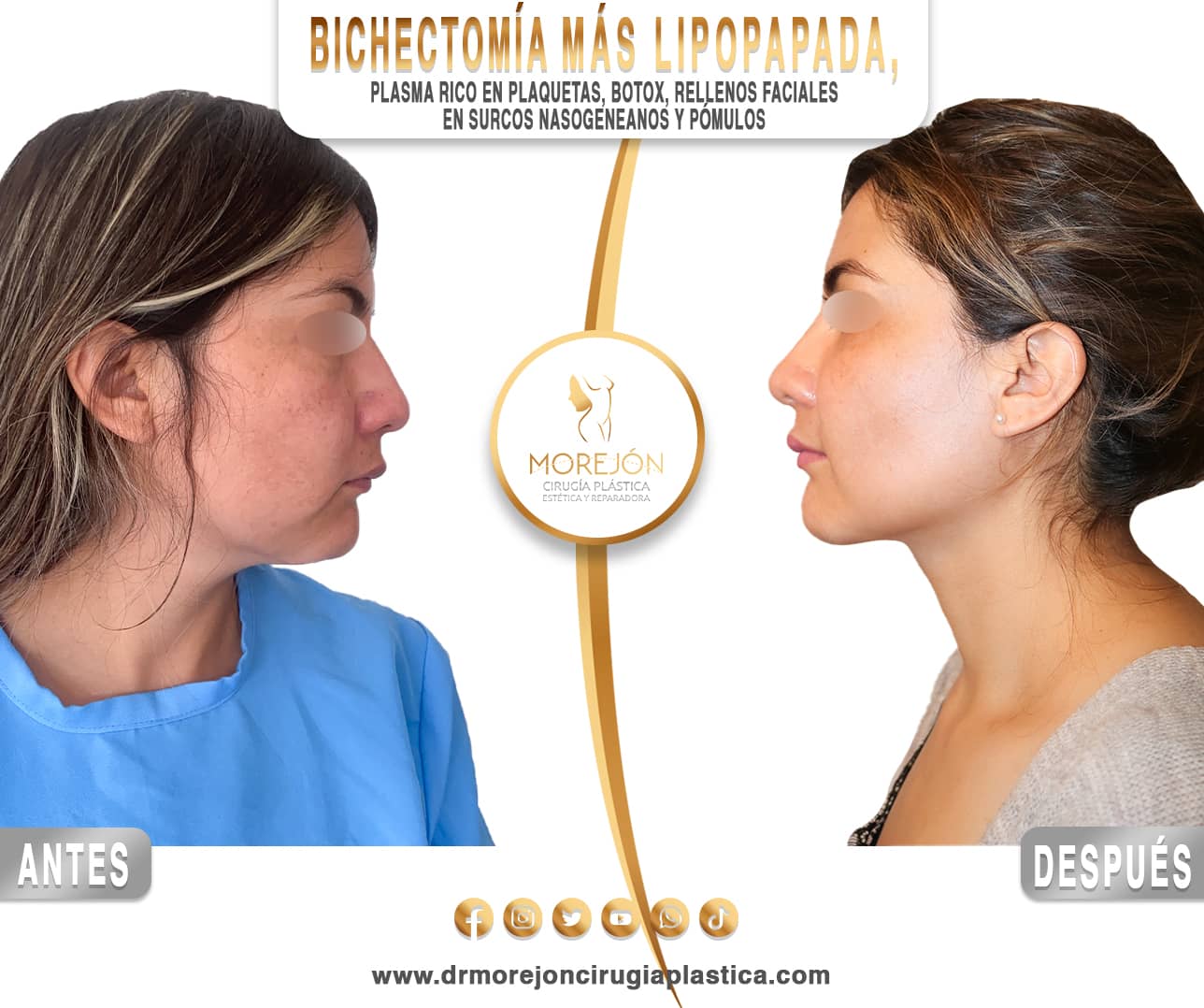 Dr. Diego Armando Morejón Cirujano Plástico Cochabamba