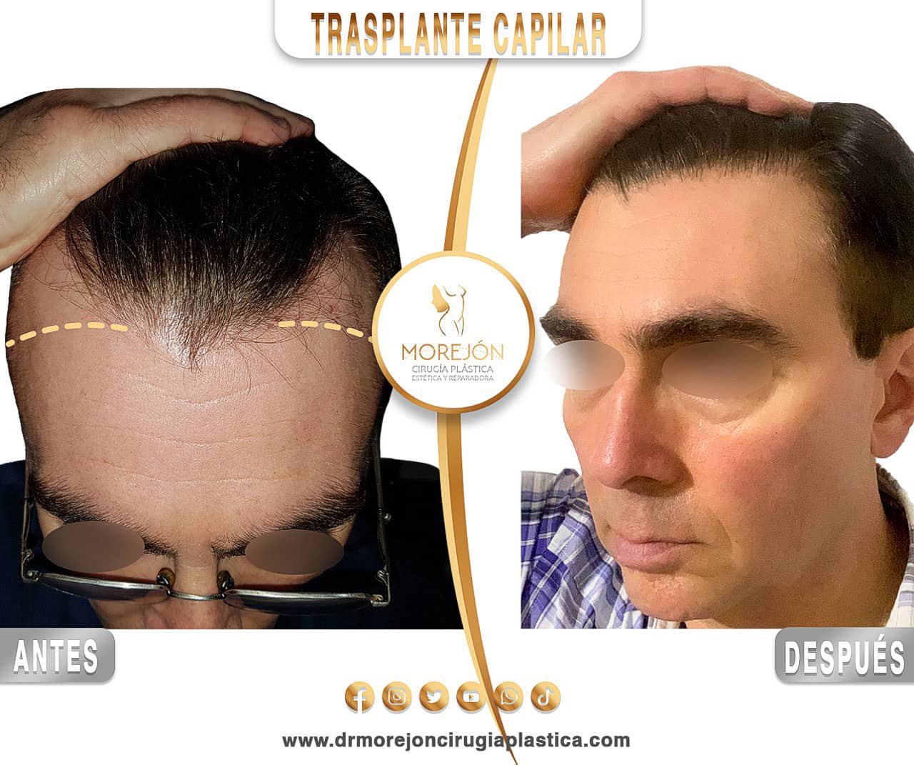 Dr. Diego Armando Morejón Cirujano Plástico Cochabamba