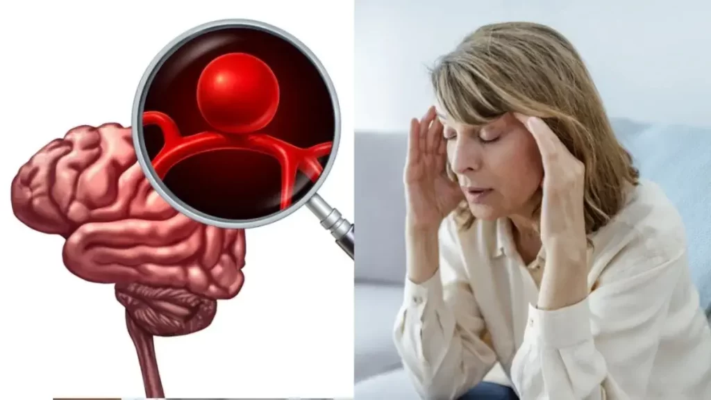 Aneurisma Cerebral Dr. Eduardo Lizarazu Gutierrez Neurocirujano Cochabamba-1