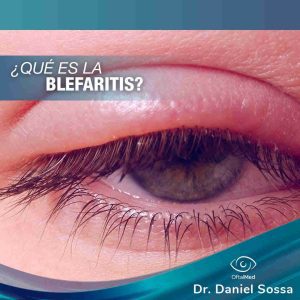 Blefaritis Dr. Daniel Sossa Mendez Cirujano Oftalmólogo Cochabamba