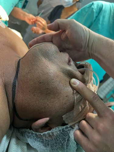 Cáncer Bucal Centro de Cirugía Bucal y Traumatología Maxilofacial en Bolivia