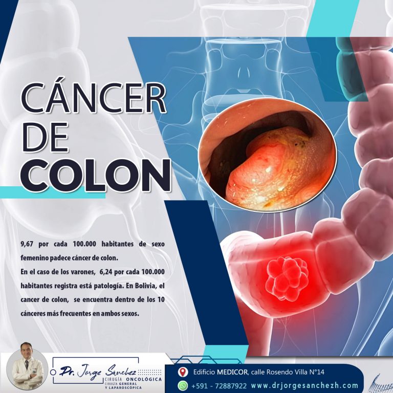 Cancer de Colon - Dr. Jorge Sanchez H. Oncologo Sucre