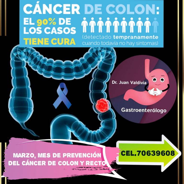 Cancer de Colon Dr. Juan Valdivia Gastroenterologo La Paz