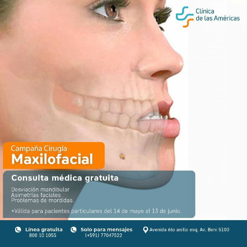 Cirugía Maxilofacial Ortognática Centro de Cirugía Bucal y Traumatología Maxilofacial en Bolivia