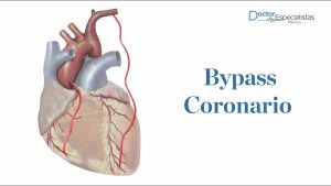 Cirugía de Bypass Coronario Dr. Carlos Brockmann Cirujano Cardiovascular en Bolivia