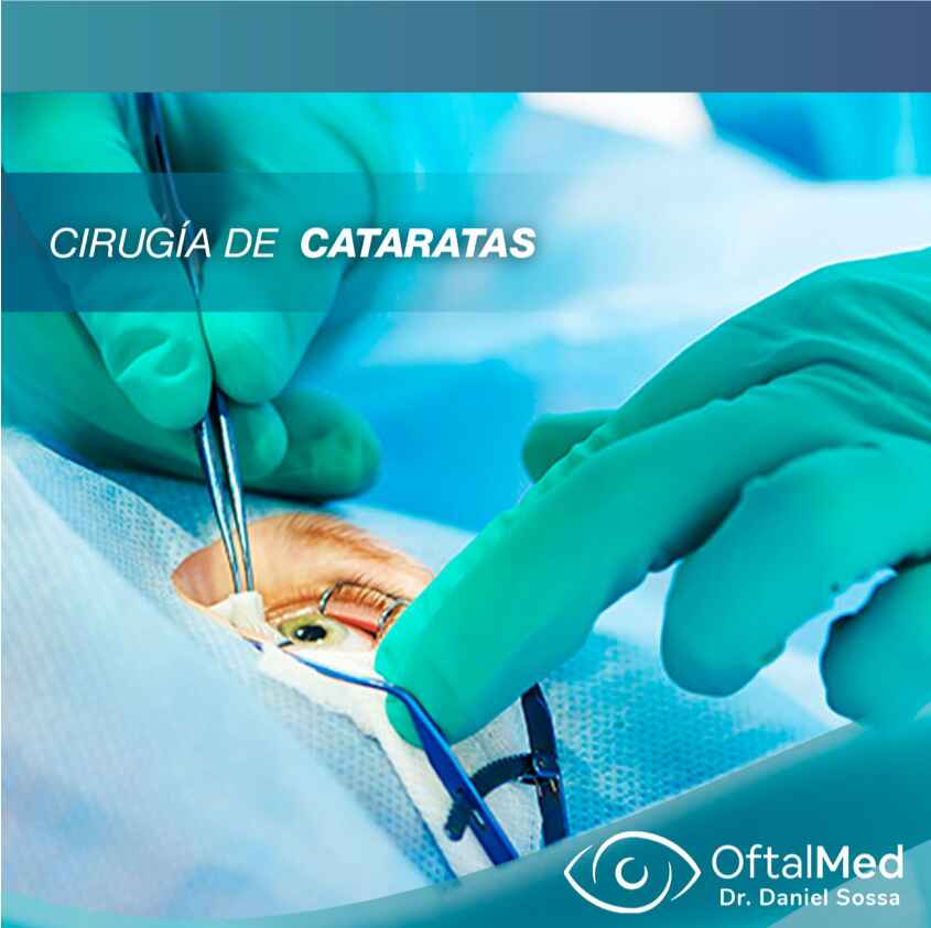 Cirugía de Catarata Dr. Daniel Sossa Mendez Cirujano Oftalmólogo Cochabamba
