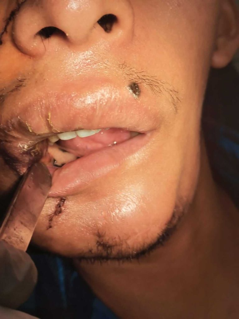 Cirujano Maxilofacial La Paz (El Alto) - Centro de Cirugía Bucal y Traumatología Maxilofacial en Bolivia 1