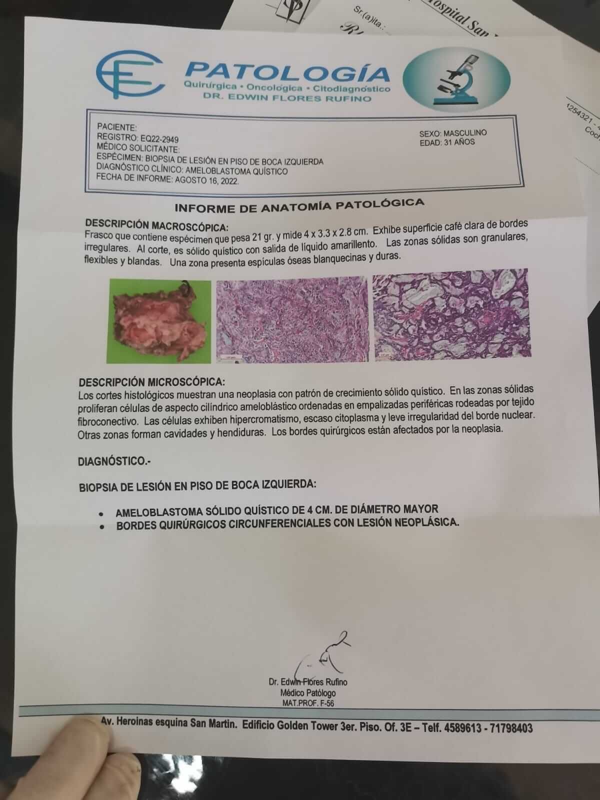 Cirujano Maxilofacial La Paz (El Alto) - Centro de Cirugía Bucal y Traumatología Maxilofacial en Bolivia(1)