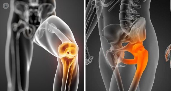 Dolor de Cadera y Rodilla - Dr. Augusto Vinicio Sempértegui Aráoz - Traumatólogo Ortopedista - Cochabamba