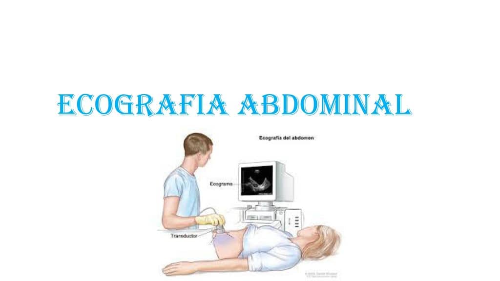 Ecografía Abdominal Dr. Mirko A. Ferrufino Merino Ecografía Avanzada Cochabamba