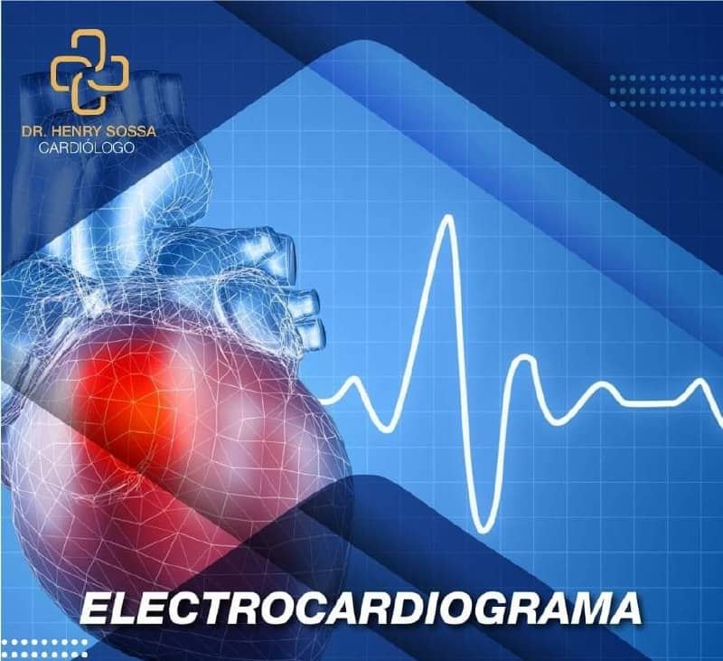 Electrocardiograma Dr. Henry Sossa H. Cardiólogo Cochabamba