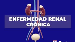 Enfermedad Renal Cronica - Dr. Israel Rivas Nefrologo Cochabamba