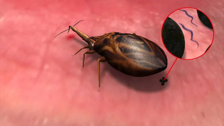 Enfermedad de Chagas Dr. Henry Sossa H. Cardiologo Cochabamba 1