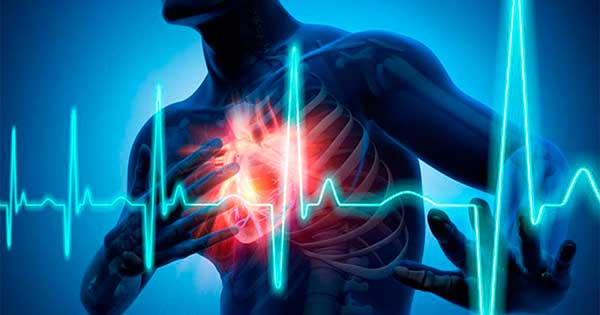 Enfermedades Cardiacas - Dr. Arturo Salazaar Vega Cardiologo Cochabamba