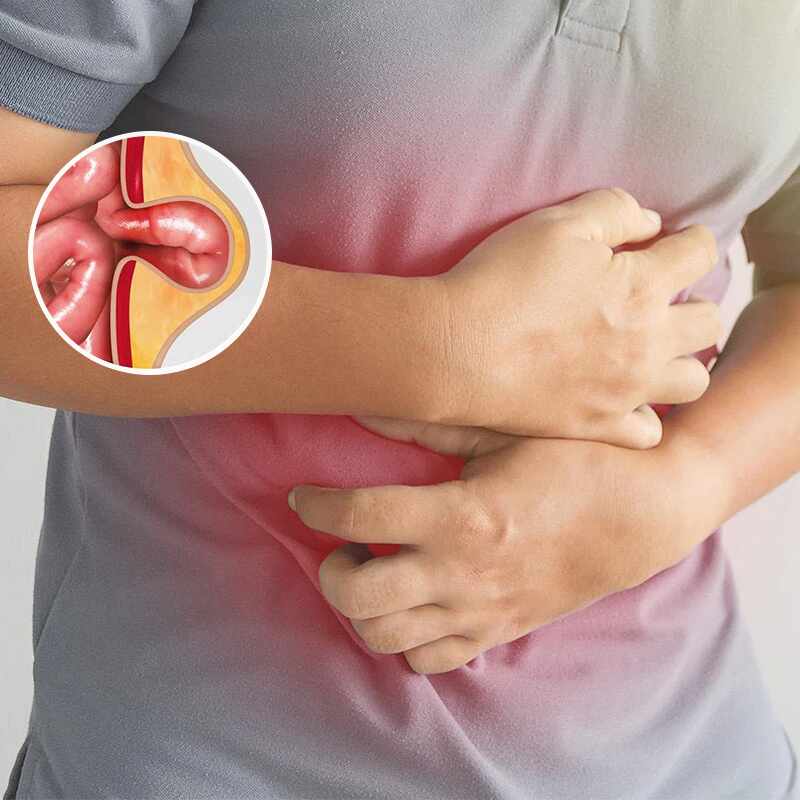 Hernia Hiatal Dr. Roger Pozzo Bobarin Cirujano General La Paz