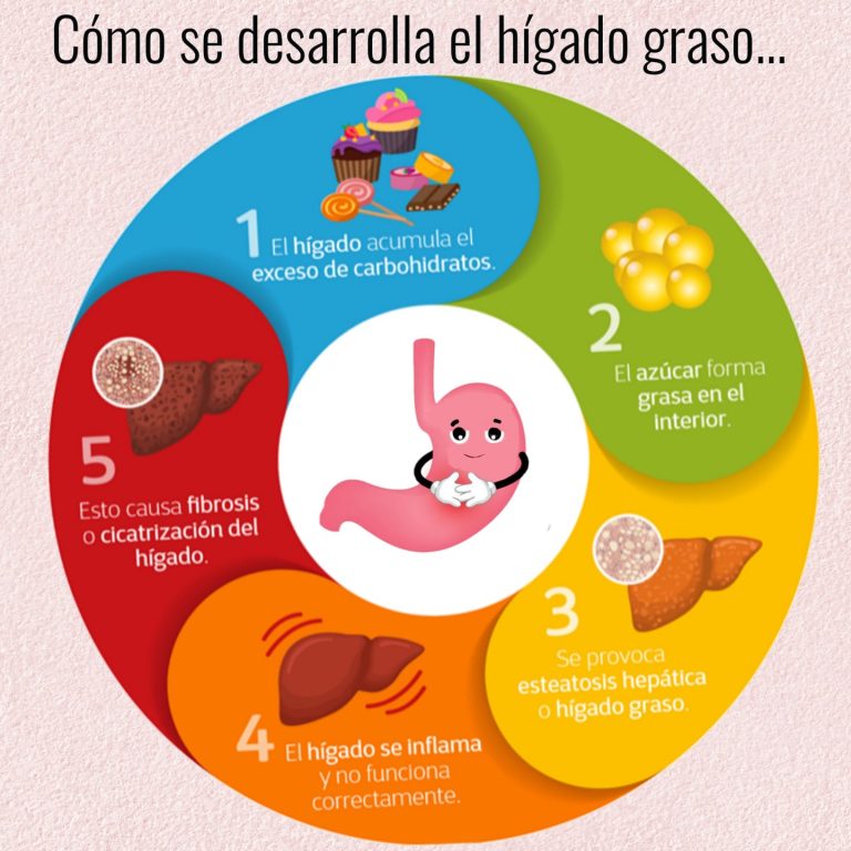 Higado Graso Dr. Juan Valdivia Gastroenterologo La Paz