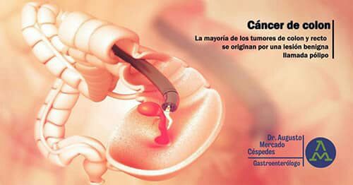 Imagen 3 Dr. Augusto Mercado Gastroenterologo en cochabamba