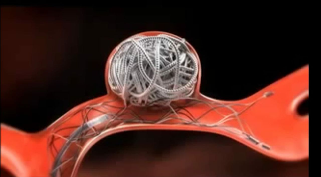 Imagen Dr. Alejandro Torrico Terceros Neurocirujano Cochabamba