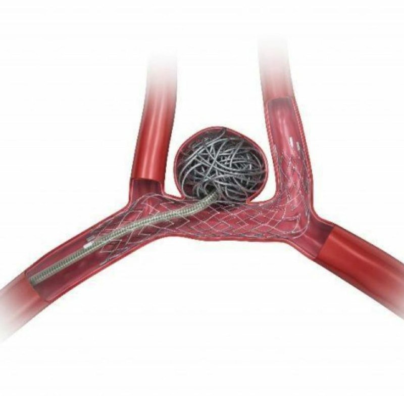Imagen Dr. Alejandro Torrico Terceros Neurocirujano Cochabamba