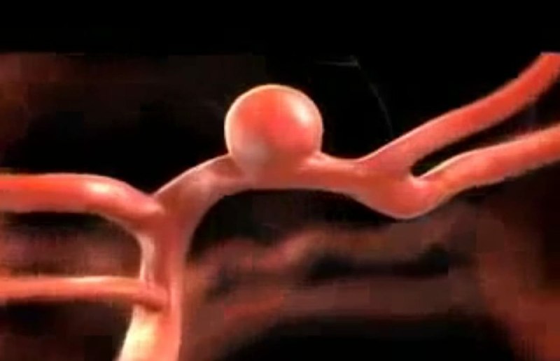 Imagen Dr. Alejandro Torrico Terceros Neurocirujano Cochabamba