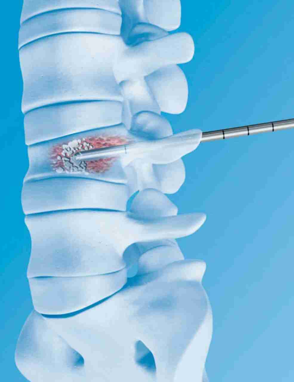 Imagen Dr. Alejandro Torrico Terceros Neurocirujano Cochabamba