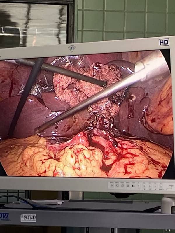 Imagen Dr. José A. Paredes J. Cirujano General Laparoscópico Cochabamba