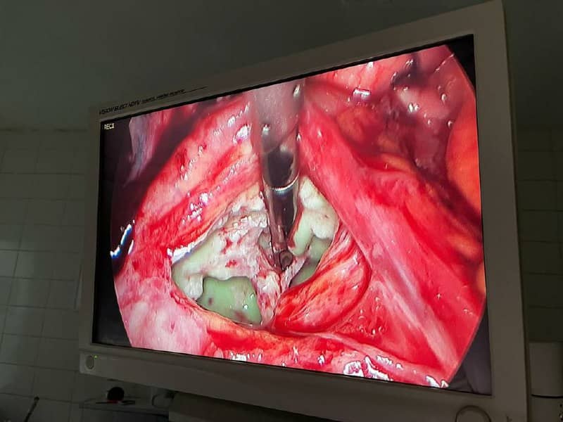 Imagen Dr. José A. Paredes J. Cirujano General Laparoscópico Cochabamba