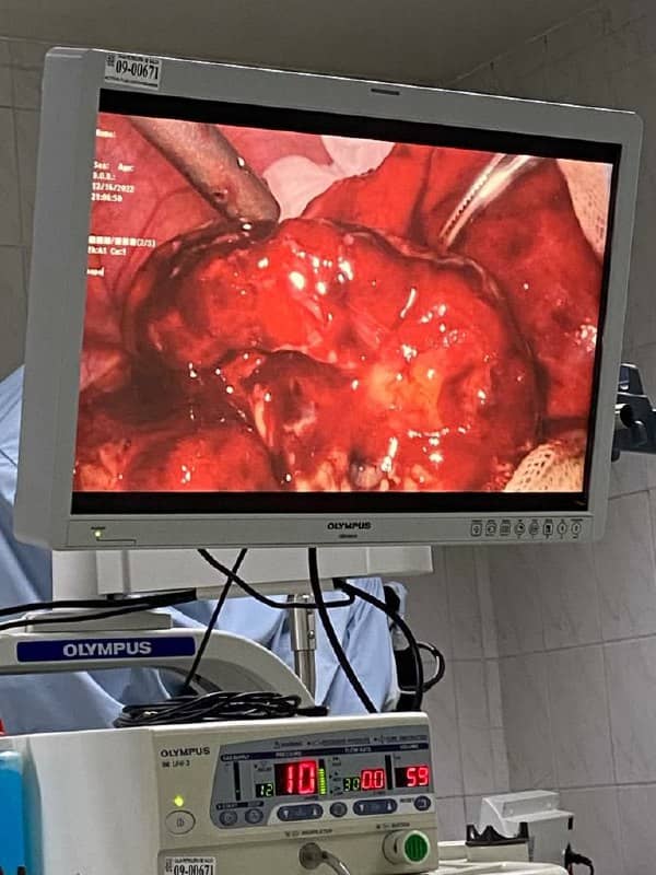 Imagen Dr. José A. Paredes J. Cirujano General Laparoscoipico Cochabamba 5(1)