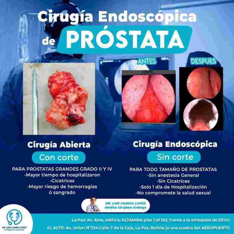 Imagen Dr. Luis Gustavo Candia Lopez Urólogo La Paz