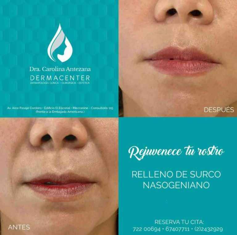 Imagen Dra. Carolina Antezana Porro Dermatóloga La Paz