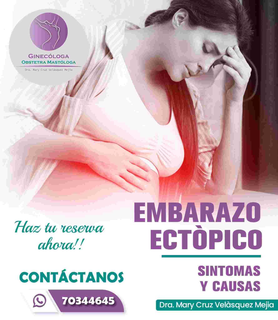 Embarazo Ectópico Dra. Mary Cruz Velásquez Mejía Ginecóloga Obstetra Cochabamba