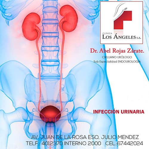 Infección Urinaria - Dr. Abel Rojas - Urólogo en Cochabamba