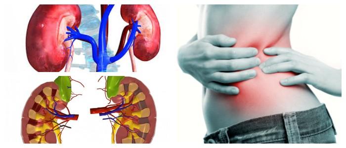 Injuria Renal Aguda - Dr. Israel Rivas Nefrologo Cochabamba