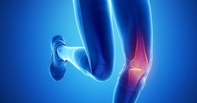 Lesión Ligamentaria de Rodilla Dr. Arnold Vergara Montán Traumatólogo Cochabamba