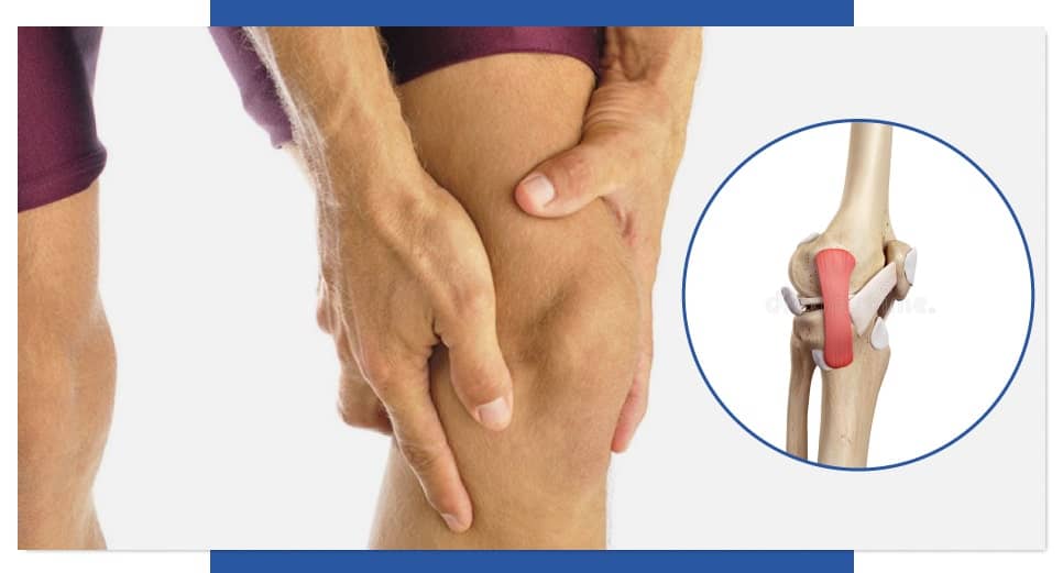 Lesión de Ligamento Colateral Lateral Dr. Arnold Vergara Montan Traumatologo Cochabamba 1