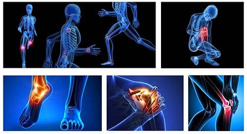 Lesiones de Rodilla Dr. Omar Mustafa Milan Traumatologo Cochabamba