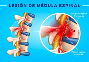 Lesiones de la Medula Espinal Dra. Ana Belén Aguilar Valencia Fisiatra Cochabamba