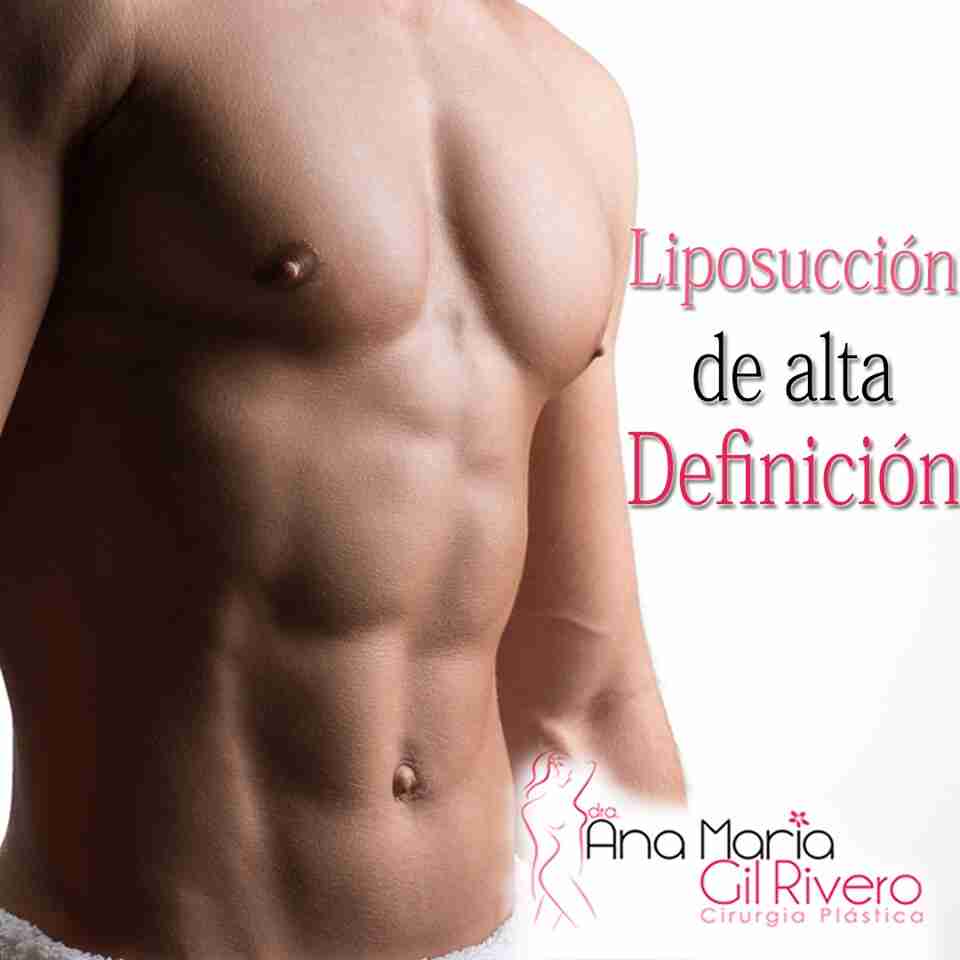Liposucción de Alta Definición Dra. Ana María Gil Rivero Cirujana Plástica Cochabamba